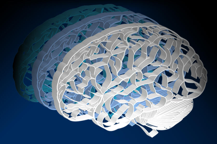 Three brains overlap as they are illuminated, symbolizing the multi-disciplinary approach of the Brain Medicine Fellowship