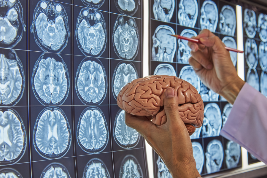 A panel of brain scans in the background, with a researcher holding a model of a brain in front.